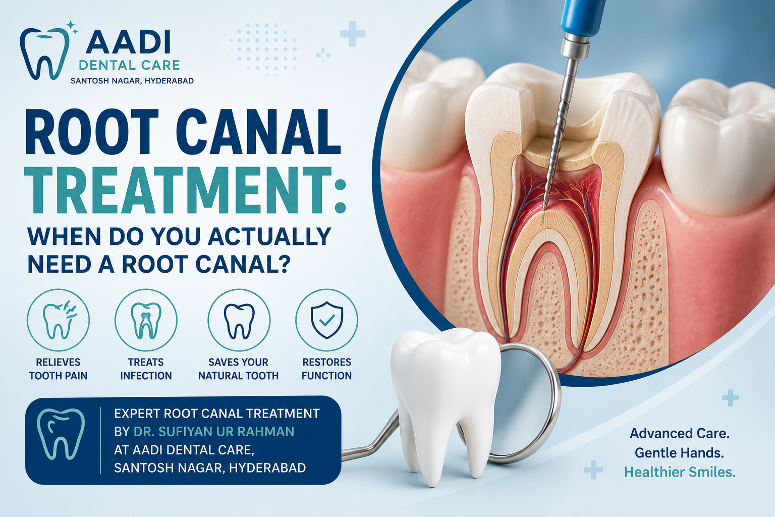Root Canal Treatment: When Do You Actually Need a Root Canal?
